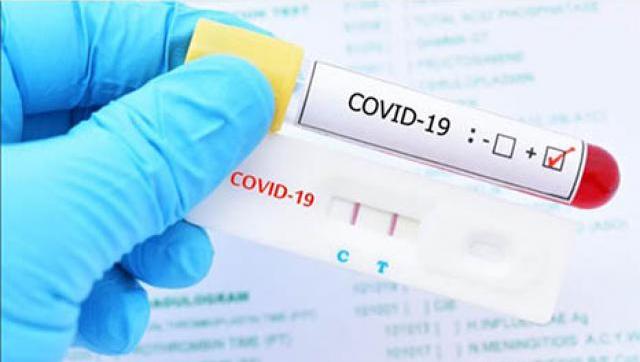 Situación y casos de Coronavirus al 19 de octubre en Moreno